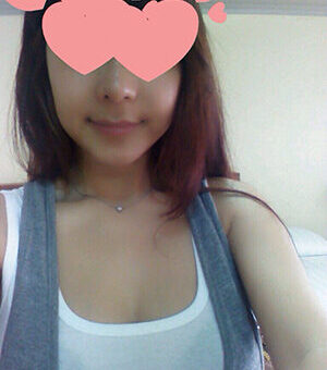 양악한지 2년되었어요~